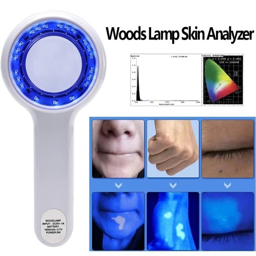Woods lamp skin analyzer - skin,