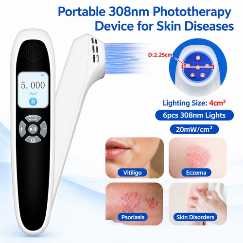 308nm lamp light therapy - 308nm,